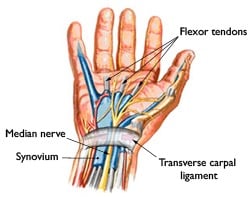 Carpal Tunnel Diagram thumb 350x