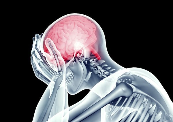 Headaches Caused by TBI