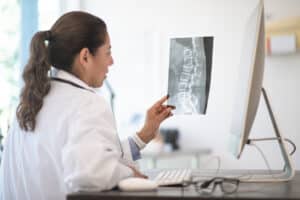 Doctor examining the x-ray results of a patient's spinal injury after an accident.